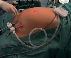 TESAR - Tecnica Chirurgica per diastasi addominale